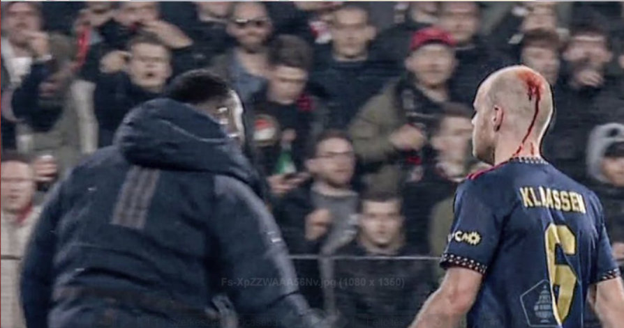 Egy szurkoló fejbe dobta az Ajax játékosát, akinek vérzett a feje –  VIDEÓ